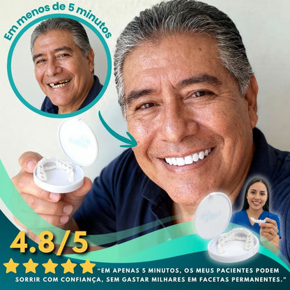 LENTE DE CERÂMICA DENTÁRIA - SMILEFLEX™